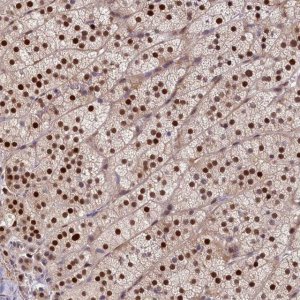 Anti-CHST12 antibody produced in rabbit 