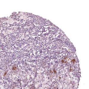 Anti-CHST14 antibody produced in rabbit 