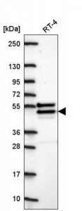 Anti-CHST14 antibody produced in rabbit 
