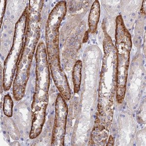 Anti-CHSY3 antibody produced in rabbit 