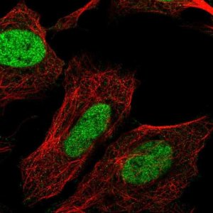 Anti-CHTF8 antibody produced in rabbit 