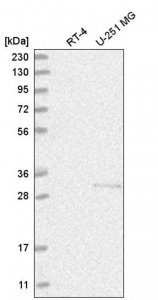 Anti-CHTOP antibody produced in rabbit 