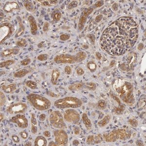 Anti-CHUK antibody produced in rabbit 