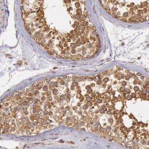 Anti-CHUK antibody produced in rabbit 