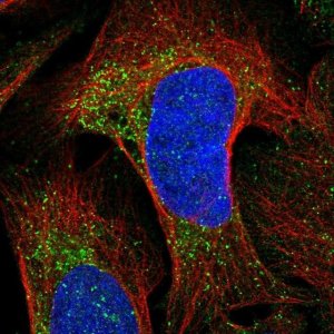 Anti-CKLF antibody produced in rabbit 