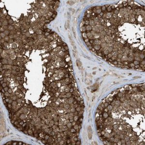Anti-CLCN6 antibody produced in rabbit 