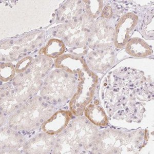 Anti-CLCNKA antibody produced in rabbit 