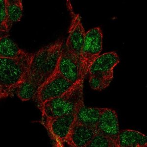 Anti-CLDND2 antibody produced in rabbit 