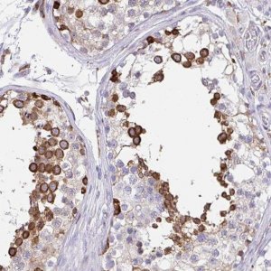 Anti-CLGN antibody produced in rabbit 