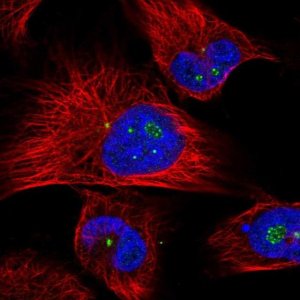 Anti-CLHC1 antibody produced in rabbit 