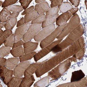 Anti-CLIC2 antibody produced in rabbit HPA060101-100UL