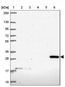 Anti-CLIC2 antibody produced in rabbit HPA060101-100UL