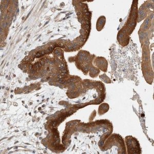Anti-CLIP1 antibody produced in rabbit 