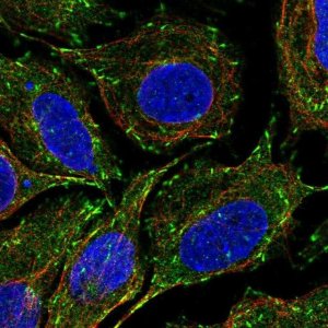 Anti-CLIP1 antibody produced in rabbit 