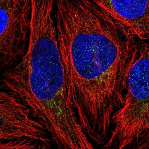 Anti-CLIP4 antibody produced in rabbit 