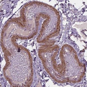 Anti-CLN3 antibody produced in rabbit 