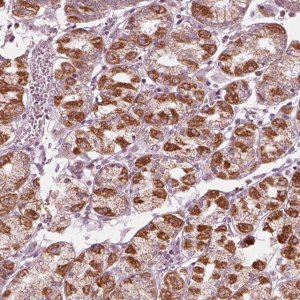 Anti-CLN6 antibody produced in rabbit HPA066046-100UL