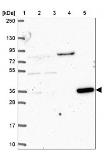 Anti-CLN6 antibody produced in rabbit HPA066046-100UL