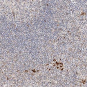Anti-CLNK antibody produced in rabbit 