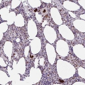 Anti-CLP1 antibody produced in rabbit 