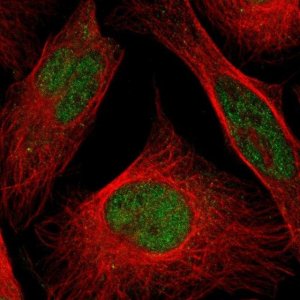 Anti-CLP1 antibody produced in rabbit 