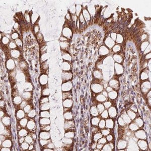 Anti-CLPB antibody produced in rabbit 