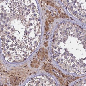 Anti-CLRN2 antibody produced in rabbit 