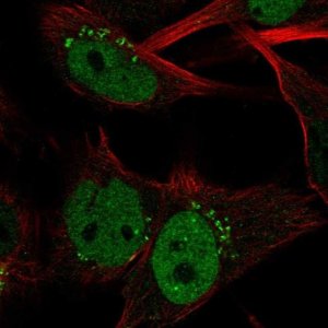 Anti-CLSPN antibody produced in rabbit 