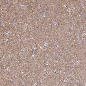 Anti-CLTC antibody produced in rabbit 