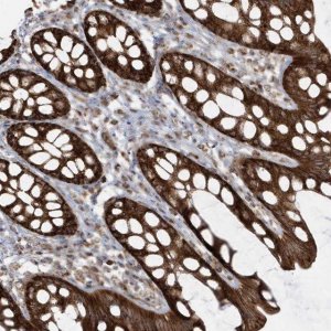 Anti-CLUAP1 antibody produced in rabbit 