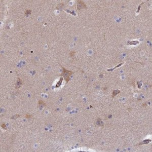 Anti-CLVS2 antibody produced in rabbit 
