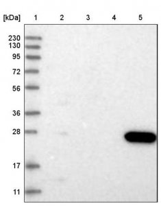 Anti-CMBL antibody produced in rabbit 