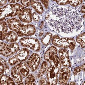 Anti-CMC1 antibody produced in rabbit 