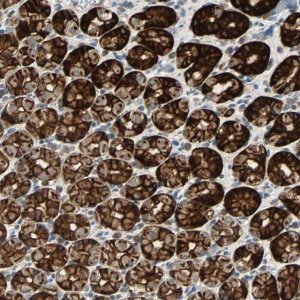 Anti-CMC2 antibody produced in rabbit 