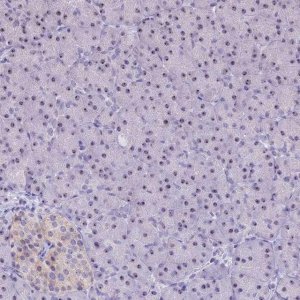 Anti-CMSS1 antibody produced in rabbit 