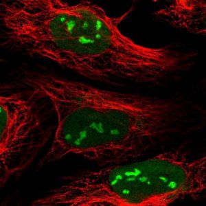 Anti-CMSS1 antibody produced in rabbit 