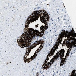 Anti-CMTM1 antibody produced in rabbit 