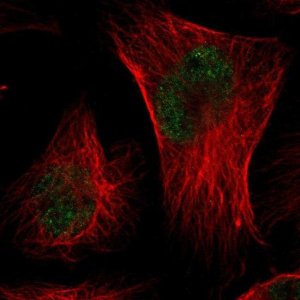 Anti-CMTM3 antibody produced in rabbit 