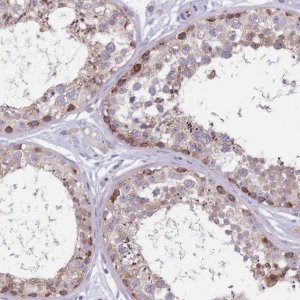 Anti-CMTR2 antibody produced in rabbit 