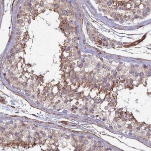 Anti-CNBD2 antibody produced in rabbit HPA043182-100UL