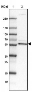 Anti-CNBD2 antibody produced in rabbit HPA043182-100UL
