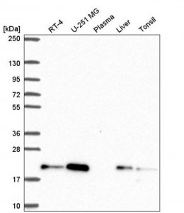 Anti-CNBP antibody produced in rabbit 
