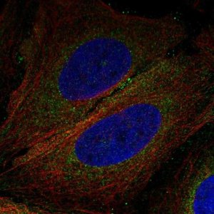 Anti-CNEP1R1 antibody produced in rabbit 