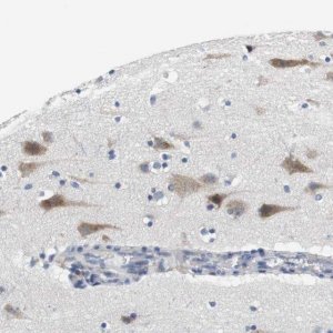 Anti-CNGA2 antibody produced in rabbit 