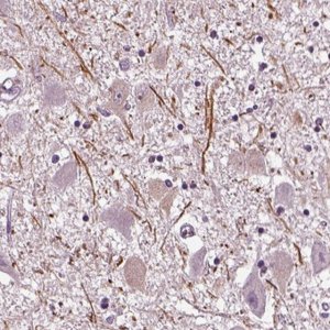 Anti-CNGA3 antibody produced in rabbit 
