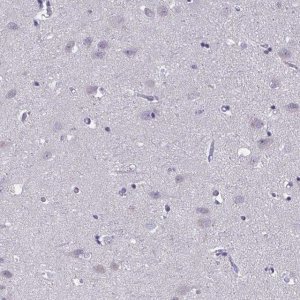 Anti-CNGB3 antibody produced in rabbit 
