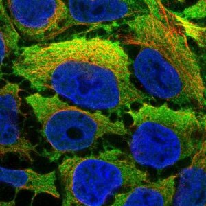 Anti-CNN2 antibody produced in rabbit 