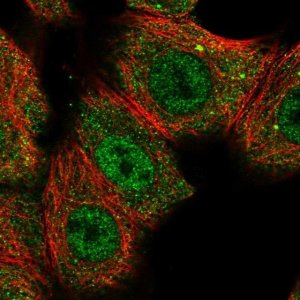 Anti-CNOT10 antibody produced in rabbit 