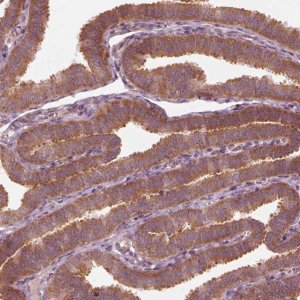 Anti-CNOT2 antibody produced in rabbit 