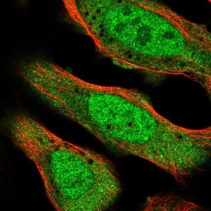 Anti-CNOT2 antibody produced in rabbit 